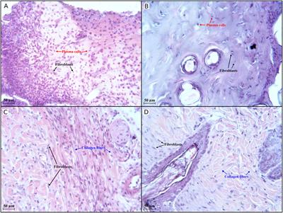 Insights in wound healing properties of water-soluble composition of dihydroquercetin and L-lysine